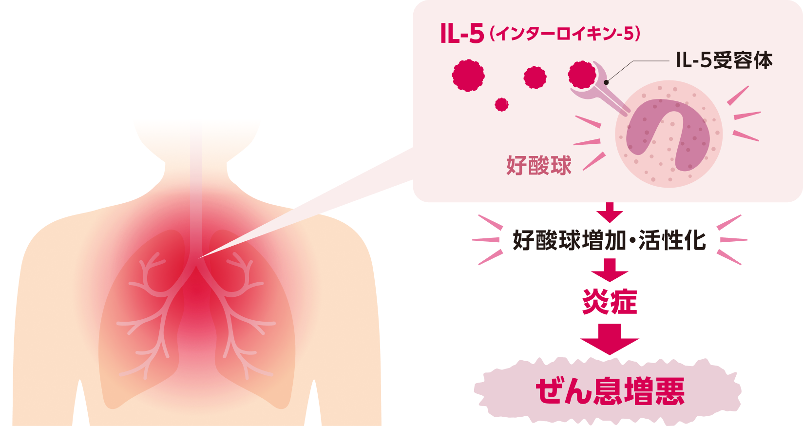 IL-5は好酸球に結合し、活性化を促すことで、ぜん息症状を悪化させます