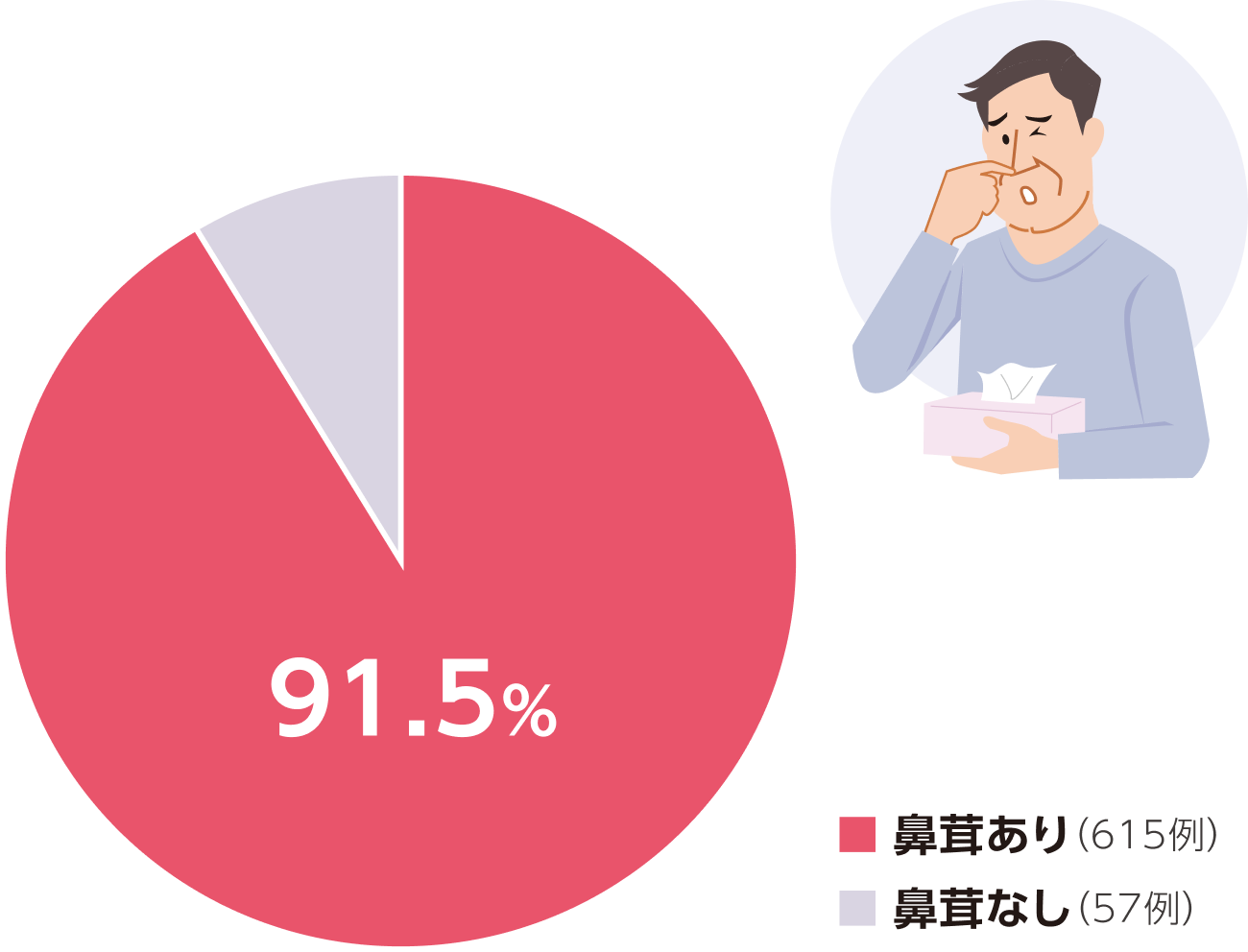 好酸球性鼻副鼻腔炎