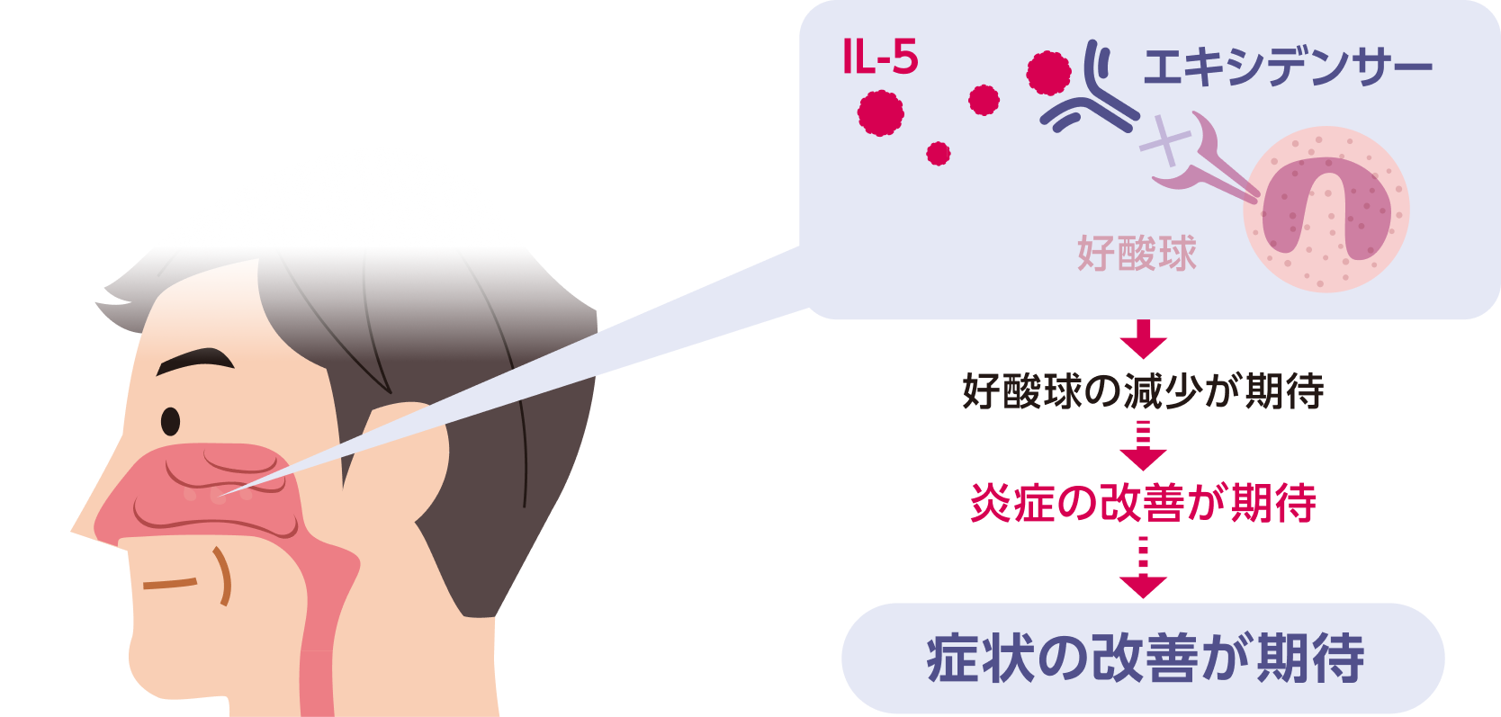 エキシデンサーは、IL-5の好酸球への結合を阻害します